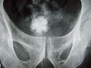 Star shaped bladder urolith on an X-ray of the pelvis.