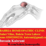 Homeopathic Treatment of Ganglion Cyst on Wrist – A Case of Causticum