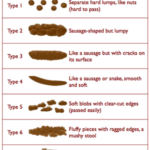 Constipation – Homeopathy Treatment and Homeopathic Remedies