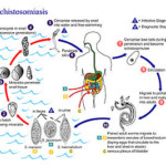 Schistosomiasis – Homeopathy Treatment and Homeopathic Remedies