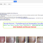 Homeopathic Treatment of Skin eruption, Allergy, Itching, Dryness, Nail Fungus – A feedback from an Online Client