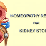 Kidney Stones – Causes, Symptoms, Homeopathy medicine and Treatment